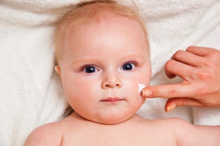 Cum este tratamentul dermatitei atopice la un copil?